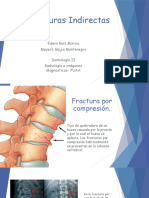 Fracturas Indirectas Final