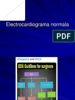 Electrocardiograma Normala