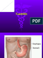 Gastritis PPT