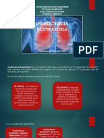 Insuficiencia Respiratoria