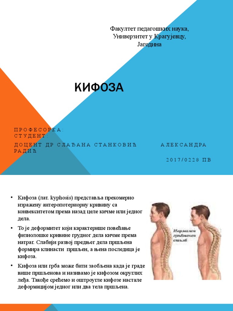 Кифоза | PDF