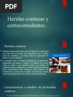 Clasificación de Contusiones Simples y Complejas | PDF | Enfermedades y ...