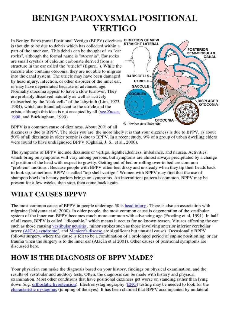 Benign Paroxysmal Positional Vertigo | PDF | Vertigo | Epidemiology