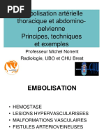 Embolisation Artérielle PDF