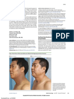 Erythema Dyschromicum Perstans Response To Isotretinoin