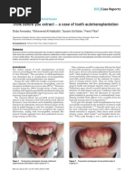 TWS S/S JERSEY 24/7:WITH:US ユニフォーム Mサイズ International Endodontic Journal PDF | PDF | Mouth | Chemistry