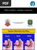 Estudo de Caso-MO-APNEIA