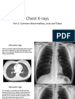 Chest Xray PT 2