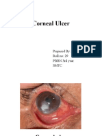 Corneal Ulcer: Prepared By: Renuka Shrestha Roll No: 29 PBBN 3rd Year SMTC