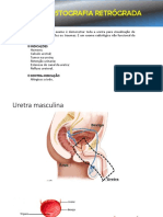 Uretrocistografia Retrógrada e Esforço PDF