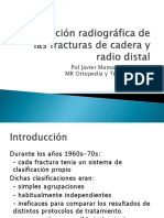 Clasificacion Radiografica de Las Fracturas de Cadera