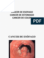 Cancer Esofago Estomago Colon