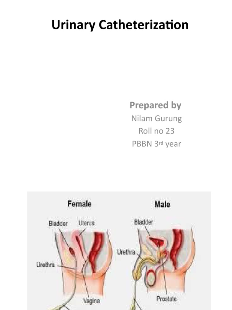 Female Urinary Catheterization Guide | PDF | Catheter | Urinary ...