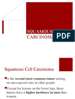 Squamous Cell: Carcinoma