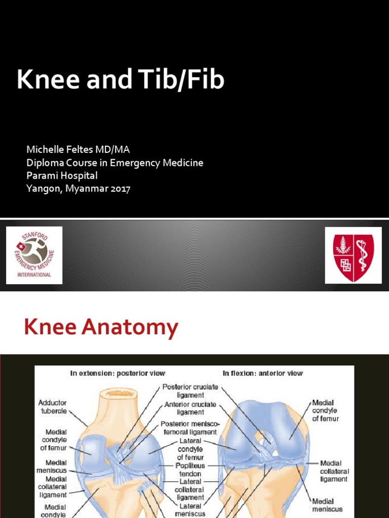 Knee and Tib Fib Fractures | PDF | Knee | Limbs (Anatomy)