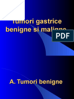 Tumori gastrice