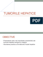 TUMORILE HEPATICE