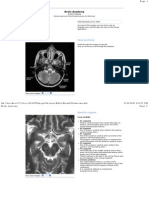 Brain Anatomy: Axial Anatomy Specific Regions