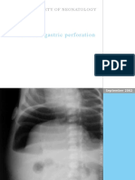 Neonatal gastric perforation