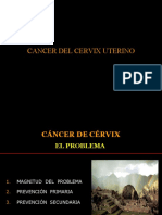 CANCER DE CERVIX - DR. GARCIA