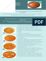 Retinopatía Hipertensiva Infografia PDF