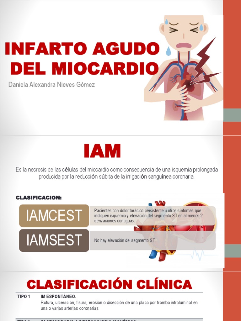 RCP Infarto | PDF | Infarto de miocardio | Electrocardiografia