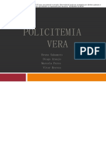 Policitemia Vera _