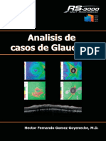 Analisis de Casos de Glaucoma Hector Fernando Gomez Goyeneche, M.D.