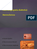 Macroangiopatia diabetică