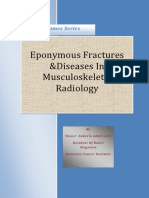 eponymous fractures and diseases of MSK radiology.pdf