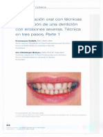 Rehabilitación adhesiva oral completa de una dentincion severamente erosionada, tencnica de los tres pasos. Parte 1.pdf