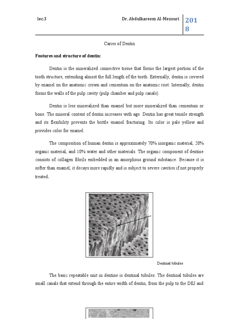 Dentin Caries: Progression and Response | PDF | Dentin | Tooth Enamel