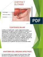 Diapositiva de Colecistitis