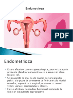 endometrioza.ppt