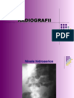 Radiografii digestiv