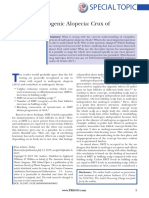 Cause of Androgenic Alopecia: Crux of The Matter: Summary: What Is Wrong With The Current Understanding of Etiopatho