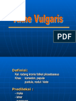 Akne Vulgaris Edit