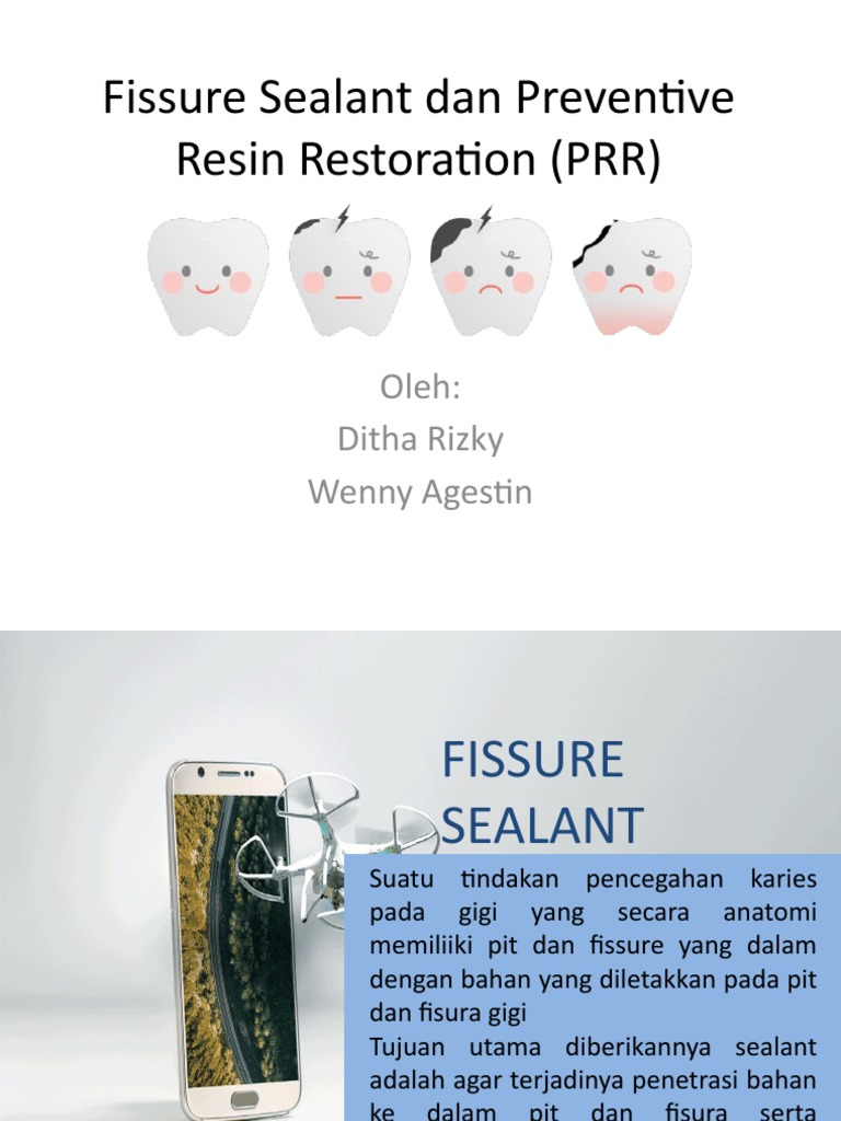 Fissure Sealant Dan Preventive Resin Restoration (PRR) | PDF