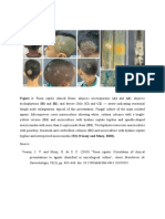 Figure 1: Tinea Capitis Clinical Forms: Alopecic Microsporosis (A1 and A2) Alopecic