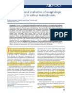 Three-Dimensional Evaluation of Morphologic Tooth Symmetry in Various Malocclusions