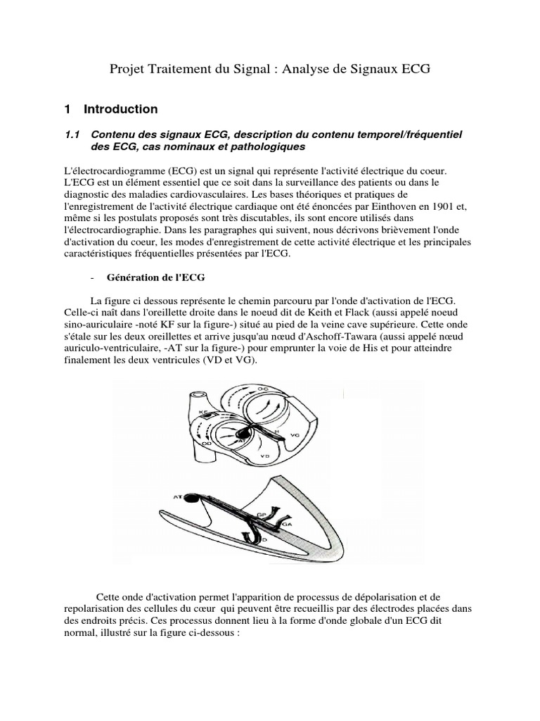 Modap TS Ursafe PDF | PDF | Électrocardiographie | Filtre (électronique)