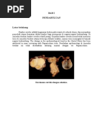Download kanker serviks emedicine by metaliasari SN46503584 doc pdf