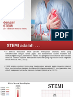 Stemi