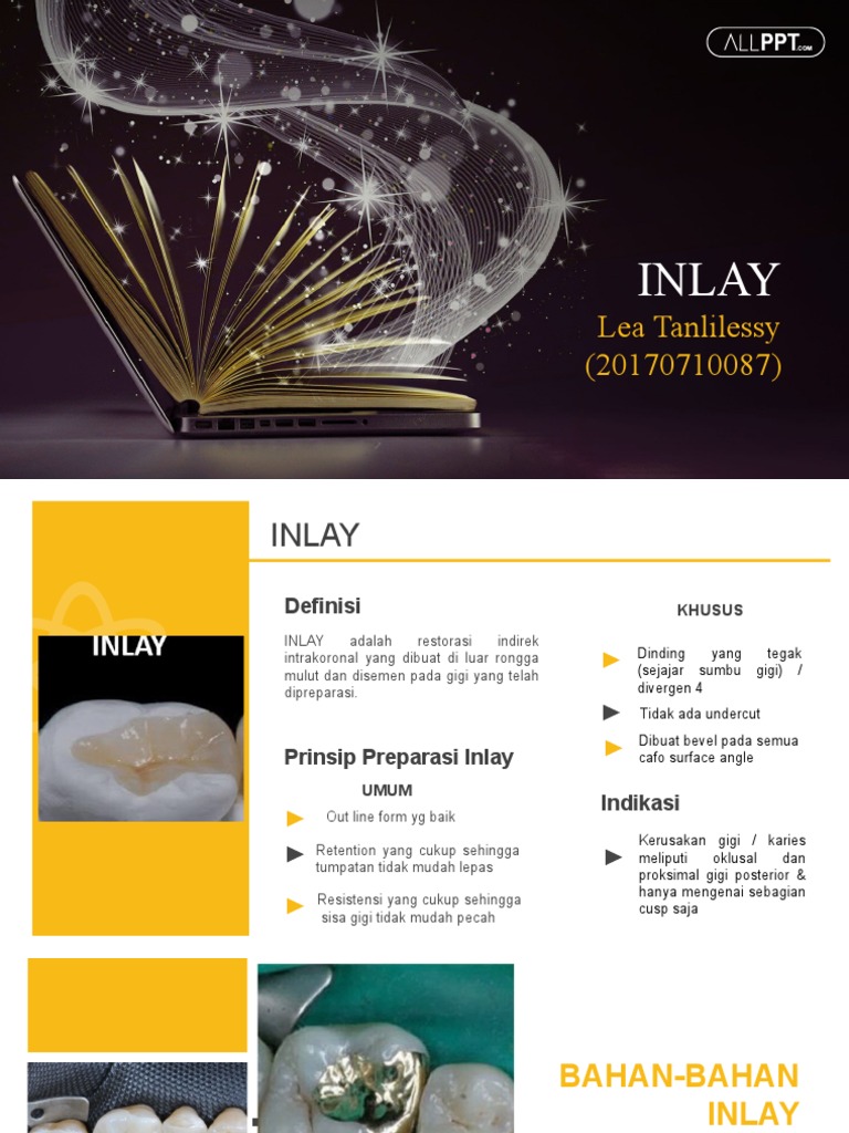 Inlay | PDF