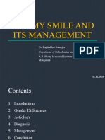 Gummy Smile and Its Management