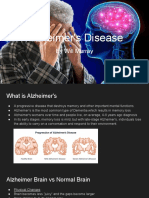 William's Alzheimer's Disease Presentation