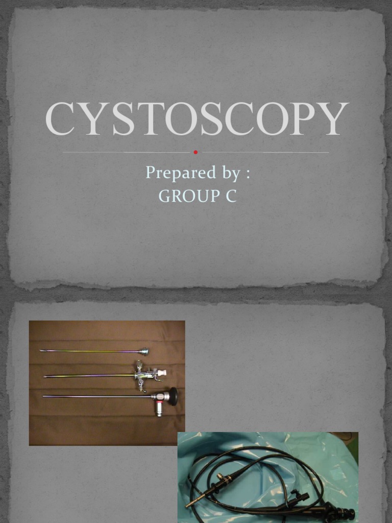Prosedur Cystoscopy: Indikasi dan Persiapan | PDF
