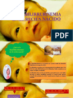 Diagnostico de Hiperbilirrubinemia en El Recien Nacido