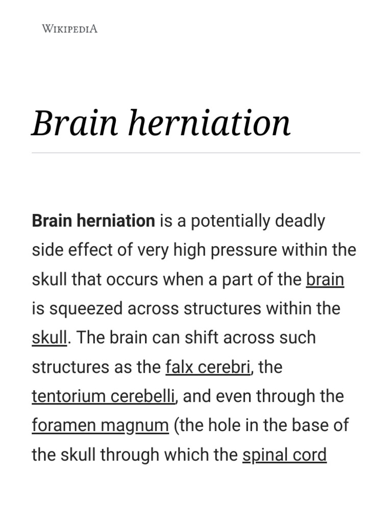 Understanding Brain Herniation Types | PDF | Central Nervous System ...