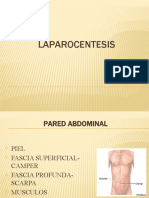 Laparocentesis